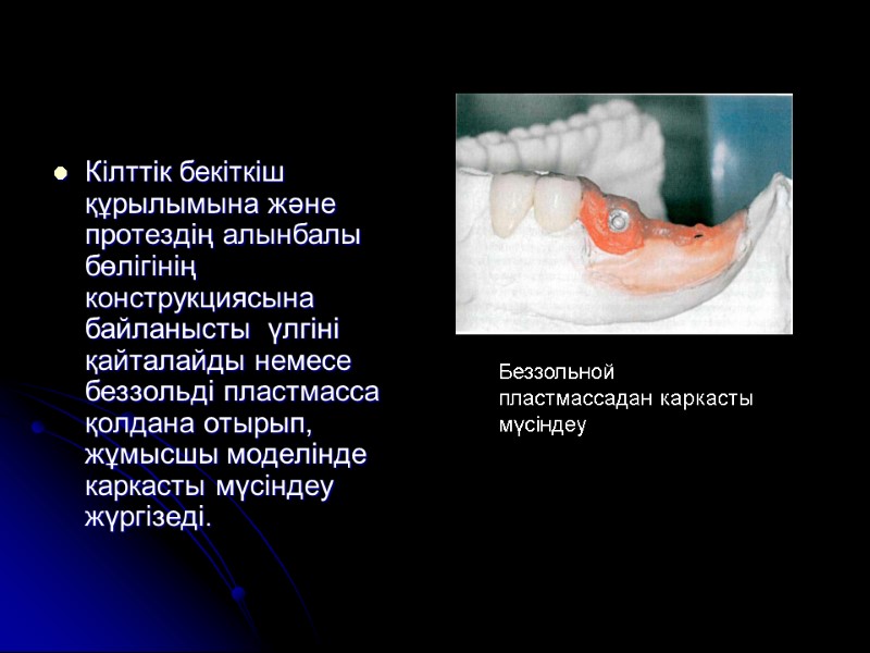 Кілттік бекіткіш құрылымына және протездің алынбалы бөлігінің конструкциясына байланысты  үлгіні қайталайды немесе беззольді